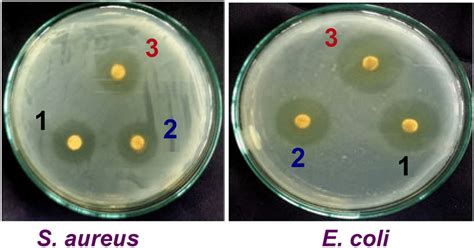 The Zone Of Inhibition Zoi In Mm Of Cd Zn S And Ni Doped