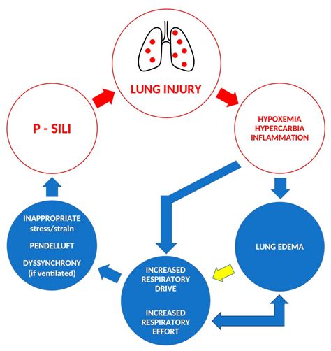 Jpm Free Full Text Patient Self Inflicted Lung Injurya Narrative