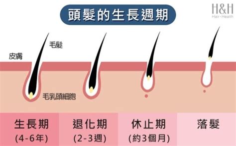 產後掉髮、懷孕落髮怎麼辦？關鍵7招教你改善產後掉髮 Handh 醫髮診所