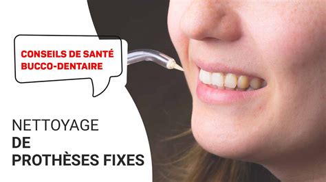 Conseils de Santé Bucco Dentaire Nettoyage des Prothèses Fixes YouTube