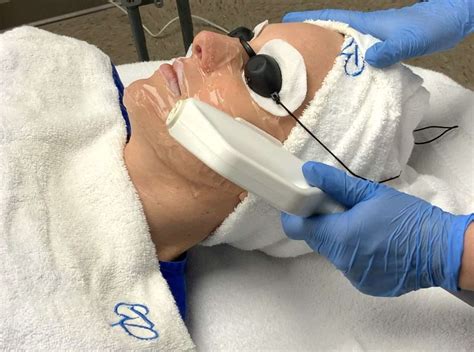 Intense Pulse Light Photofacial Ipl B At The Top Windsor