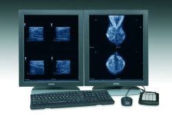 Agfa HealthCare Launches New Digital Mammography Functionality Within