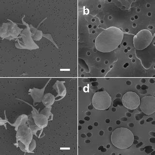 Representative Scanning Electron Micrographs Of In Vitro Blood Clots