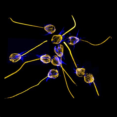 Choanoflagellate Swarming and [IMAGE] | EurekAlert! Science News Releases