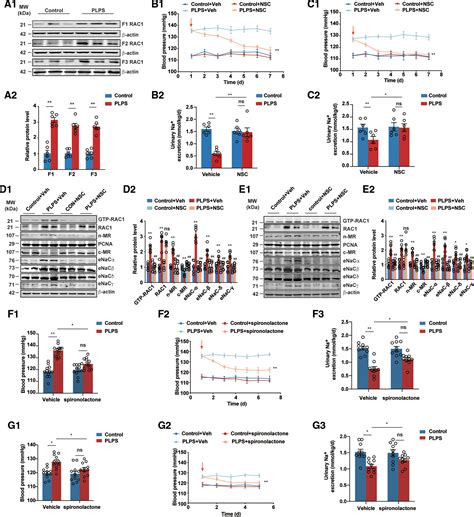 Prenatal Lipopolysaccharides Exposure Induces Transgenerational