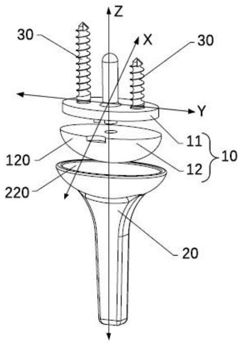 Wrist Joint Prosthesis Eureka Patsnap