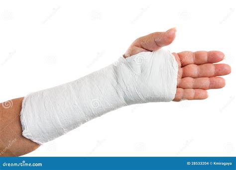 Broken Arm With A Plaster Cast Stock Photo Image Of Emergency Injury