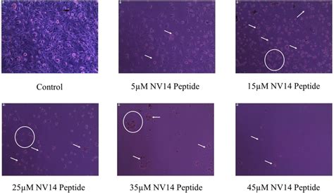 Effect Of Nv14 Peptide In Cellular Morphology In Mcf 7 The Cells Were Download Scientific