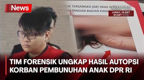 Mencengangkan Tim Forensik Ungkap Hasil Autopsi Korban Pembunuhan Anak Dpr Ri Youtube