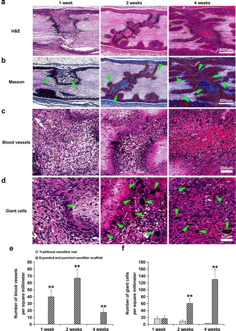 In vivo response of expanded nanofiber scaffolds with arrayed holes and ... 