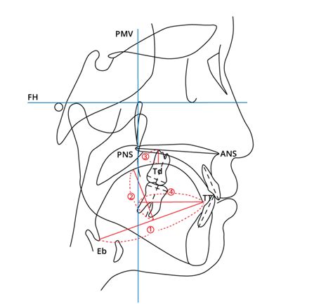 Schematic Illustration Of Cephalometric Measurements Tgl Mm