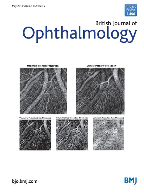 Laser In Glaucoma And Ocular Hypertension LiGHT Trial A Multicentre