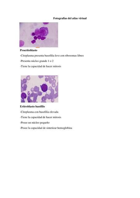 Fotograf As Del Atlas Virtual Hematolog A Sirgee Quintano Udocz