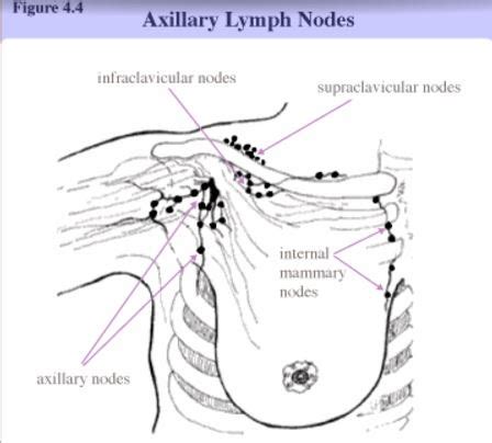 Axillary Lymph Nodes Cancer Symptoms