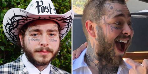 Post Malone: Before And After Transformation - OtakuKart