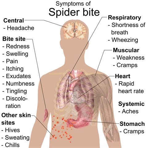 Hobo Spider Bite, Symptoms and Preventive Measures- Charlies