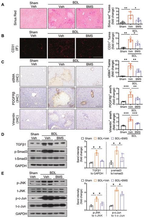 Pharmacological Inhibition Of A Fabp Alleviates Bdl Induced Liver