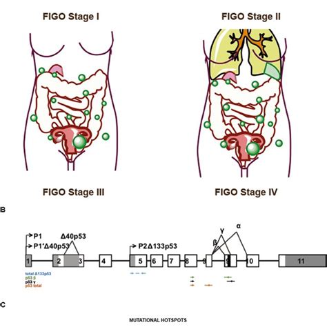 A Overview Of Figo Disease Stages Represented By The Series For This Download Scientific