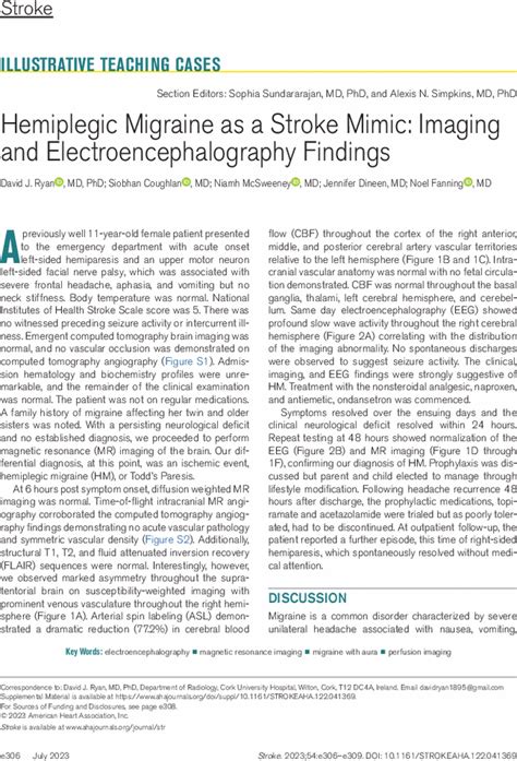 Hemiplegic Migraine As A Stroke Mimic Imaging And