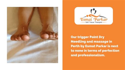 Ppt Trigger Point Dry Needling And Massage In Perth Powerpoint Presentation Id 11543401