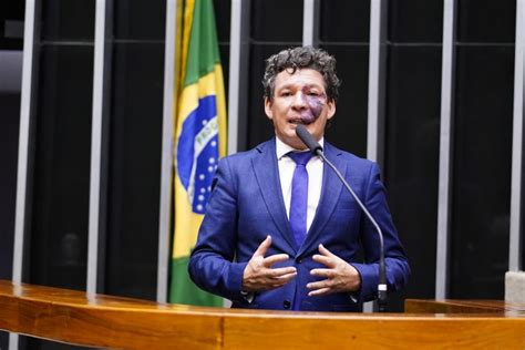 Lira Cria Grupo De Trabalho Para Debater Reforma Tribut Ria Deputado