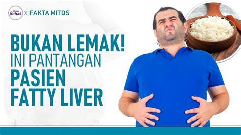 Sering Keliru Ini Jenis Makanan Yang Harus Dihindari Penderita Fatty