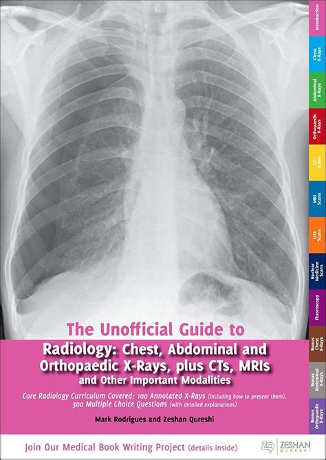 Unofficial Guide To Radiology Chest Abdominal And Orthopaedic X Rays