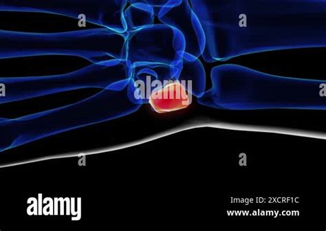 Triquetral bone Stock Videos & Footage - HD and 4K Video Clips - Alamy