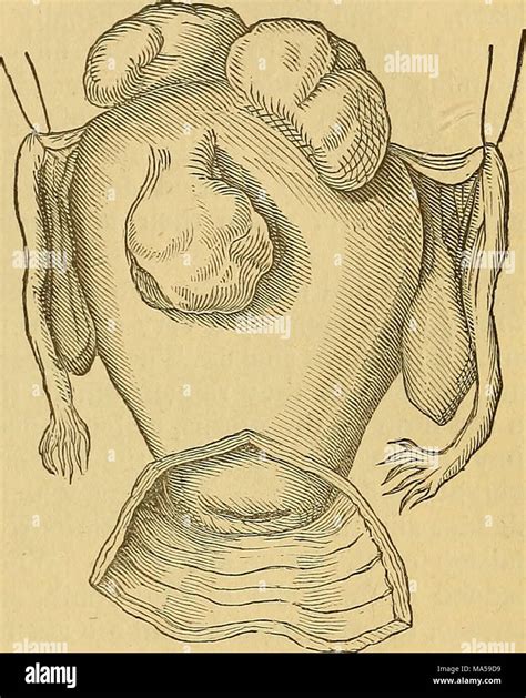 . Elements of pathological anatomy Stock Photo - Alamy