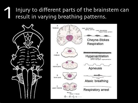 Ataxic Breathing