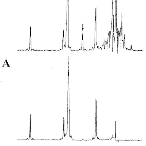 1 H Nmr Spectra Of The Anomeric Proton Regions Of Pnp G8 And Its