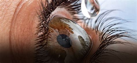 Revolutionary Eye-drops Developed By Israeli Ophthalmologist