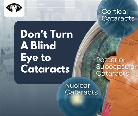 Understanding The Types Of Cataracts And Their Symptoms