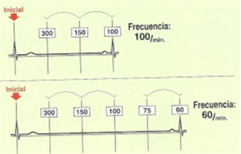 Como Se Calcula Frecuencia Cardiaca En Electrocardiograma Catalog Library