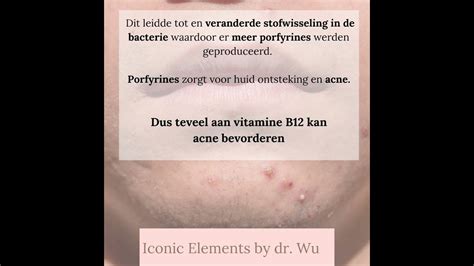 Vitamine B12 Een Oorzaak Voor Puisten Youtube