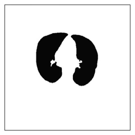 The airway-free initial lung mask. (a) The original image; (b) the ...