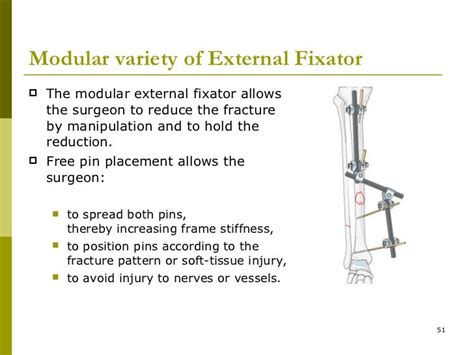 External fixator