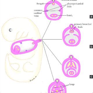 (PDF) Congenital Absence of the Right Pericardium: Embryology and Imaging