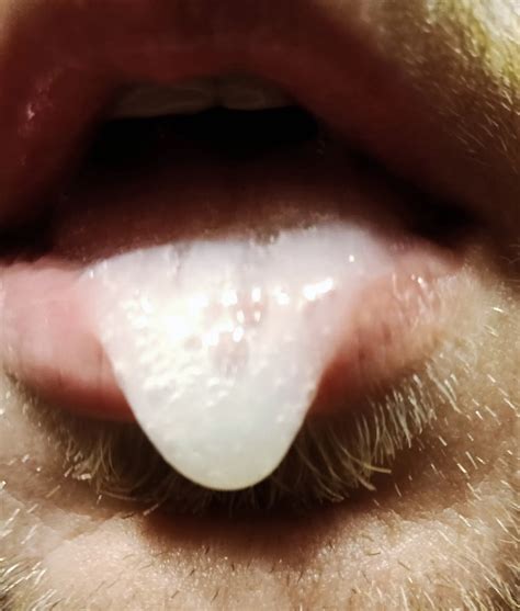 Cum On Mounth Nude Pics XHamster