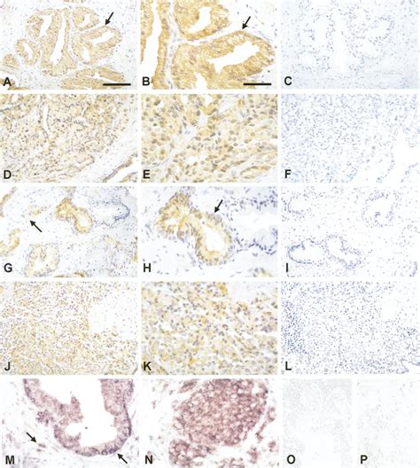 Localization And Expression Of A Subunit Mrna And Protein In