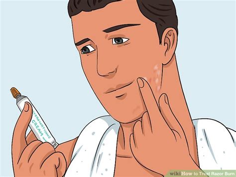 How To Treat A Razor Burn