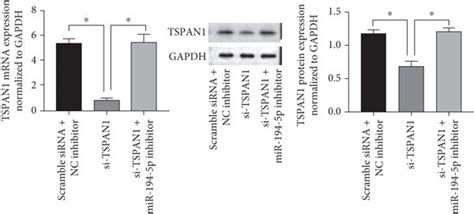 Mir 194 5p Leads To A Targeted Inhibition Of Tspan1 And Regulates Oc