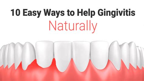 10 Easy Ways To Help Gingivitis Naturally