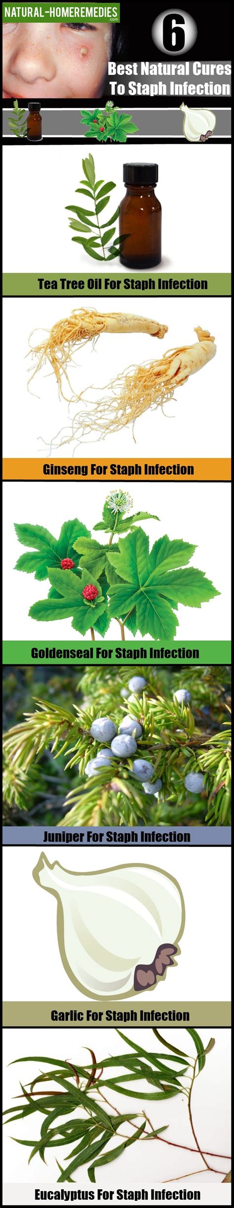 6 Best Natural Remedies For Staph Infection – Natural Home Remedies ...