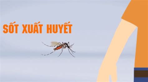 Bệnh sốt xuất huyết có lây không Vinmec