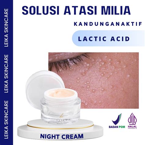 Jual Cream Milia Penghilang Milia Paling Ampuh Cream Milia Ampuh Bpom Penghilang Milia