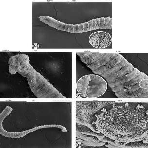 Scanning electron micrographs of H. nana: a) Adult H. nana with scolex,... | Download Scientific ...