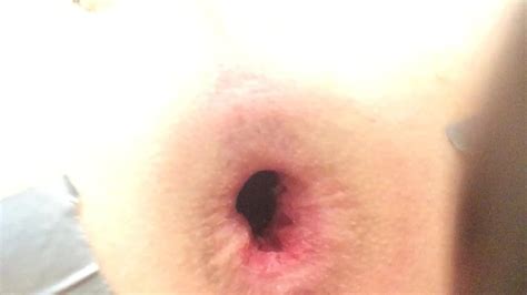 Inflatable Buttplug Gay Anal Porn XHamster