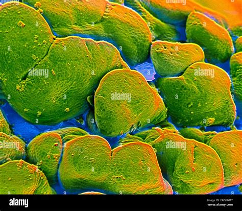 False-colour scanning electron micrograph (SEM) of the surface of the ... 