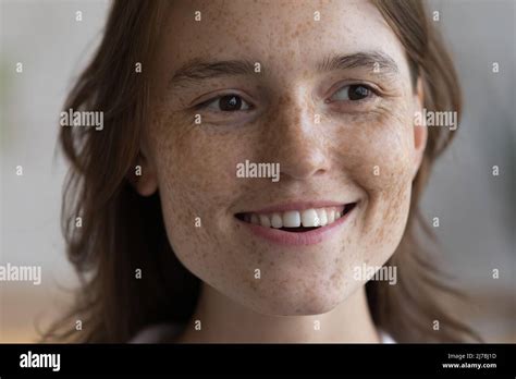 Irish girl with freckles hi-res stock photography and images - Alamy